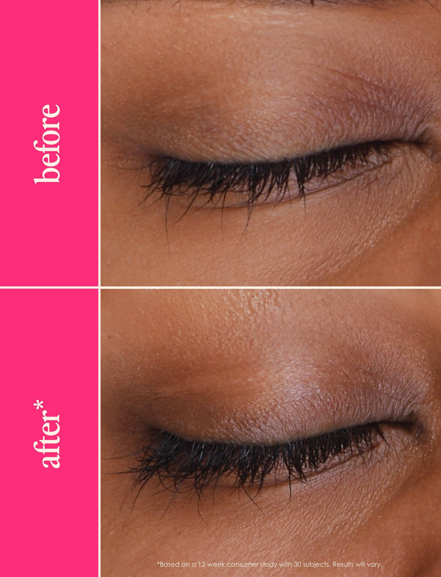 GrandeLASH-MD Lash Enhancing Serum: 2 mL (3 Month Supply)